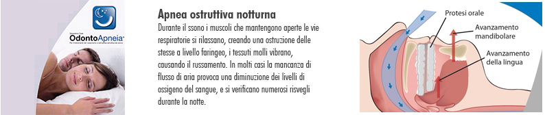 Vetrina
